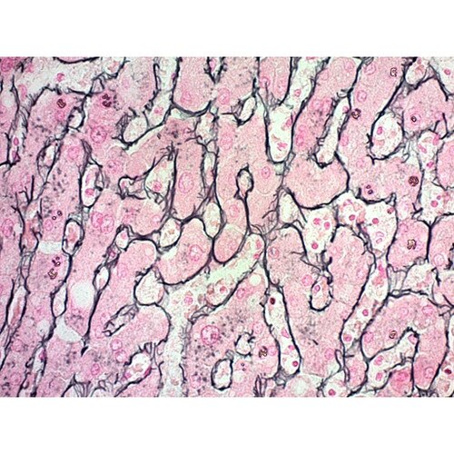 Reticulum Gomoris Stain Kit Liver Reticulin