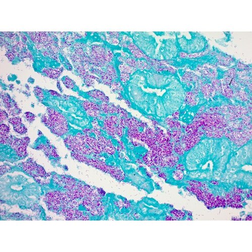 acid fast bacteria stain kit carbol fuchsin