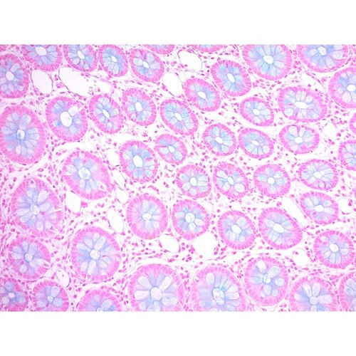 Alcian Blue (pH 1.0) Stain Kit