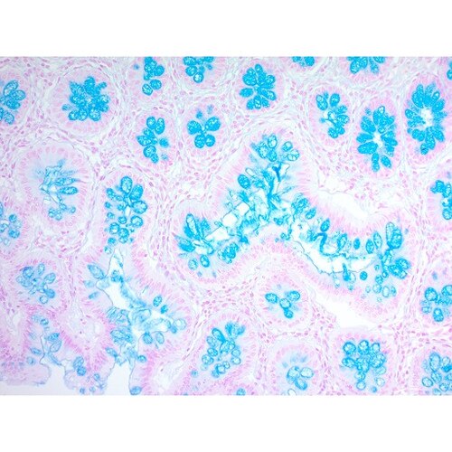 Alcian Blue Stain Kit ph2.5 mucin goblet