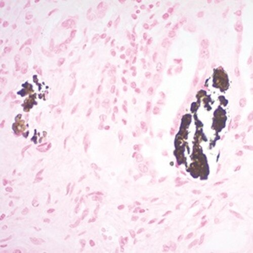 Calcium Stain Kit, (Von Kossa)