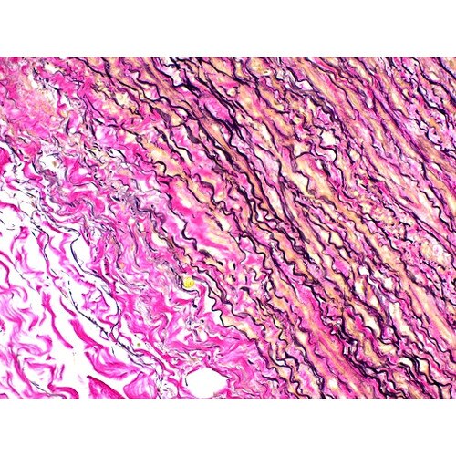Elastic Stain Kit (Modified Verhoeffs) Elastin