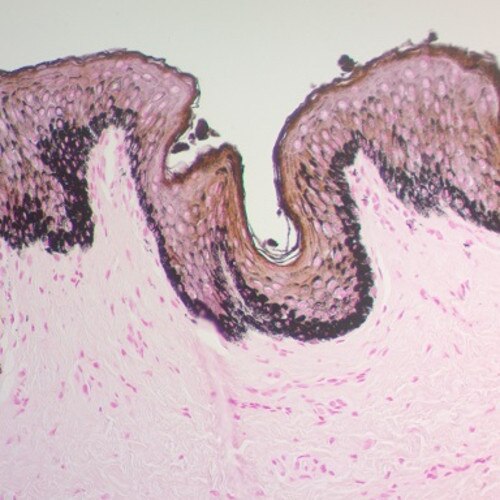 The Fontana-Masson Stain Kit