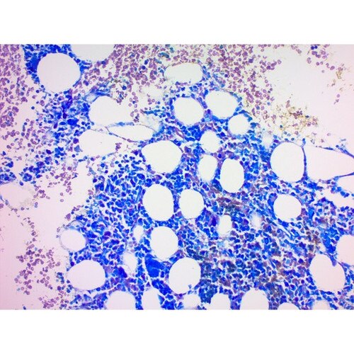Giemsa Stain Kit May Grunwald Bone Marrow