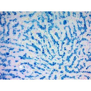 Prussian Blue reaction of Iron Stain Kit, Volume Optimized SS1013-VO