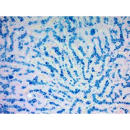 Prussian Blue reaction of Iron Stain Kit, Volume Optimized SS1013-VO