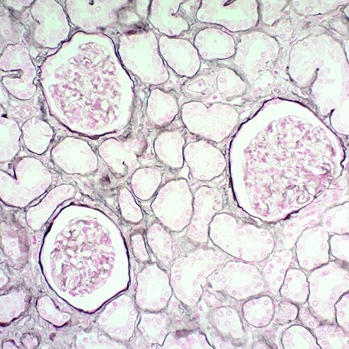 Jones Stain Kit, Volume Optimized,