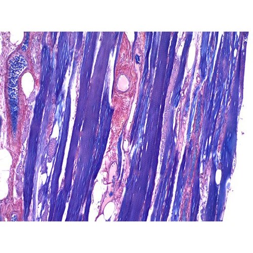 PTAH Stain Kit for Microwave (Phosphotungstic Acid Hematoxylin), Volume Optimized