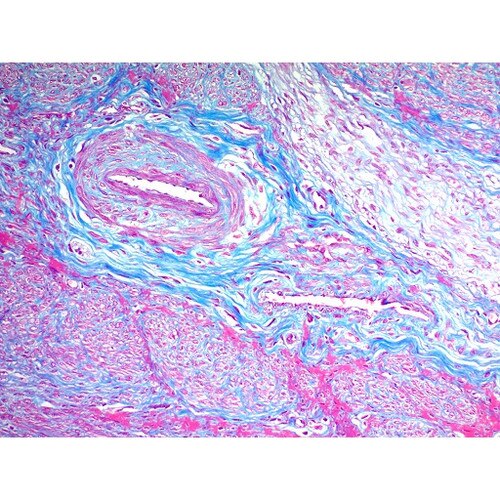 Trichrome Stain Kit, Modified Gomori's