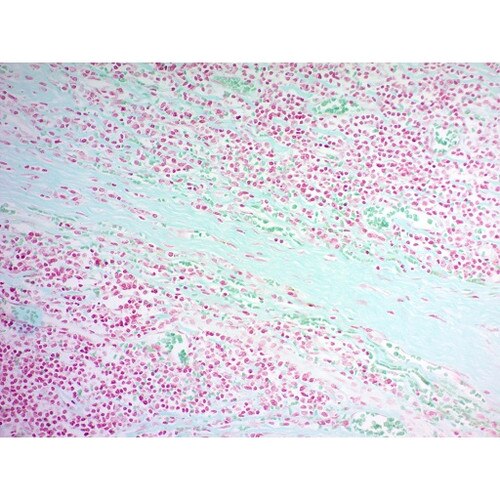 Twort's Counterstain Kit