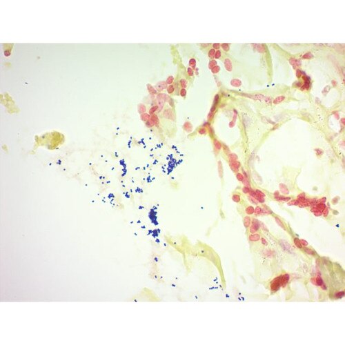 Gram Stain Kit (Modified Brown & Brenn)
