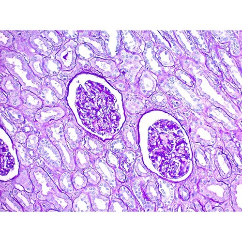 PAS Periodic Acid Schiff Stain Kit on Kidney