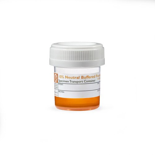 Prefilled Formalin with Eosin Tint