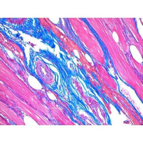 Trichrome Stain, Blue One-Step