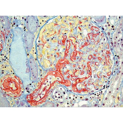 Martius Scarlet Blue (MSB) Stain Kit on Horse Liver: Courtesy of University of Montreal