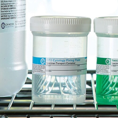 CF2 Cytology Fixative (Pre-fill)
