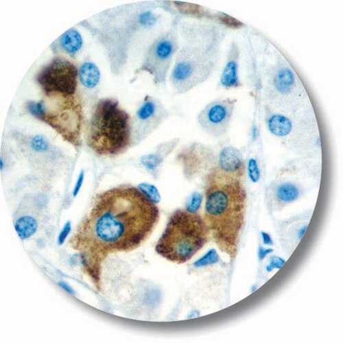 IHC of ACTH on an FFPE Pituitary Tissue