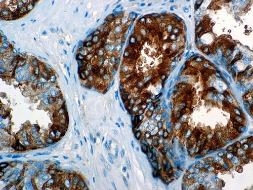 IHC of AFP on an FFPE Fetal Liver Tissue