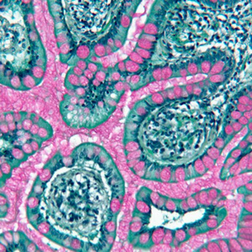 EZ Green A counterstain on Colon