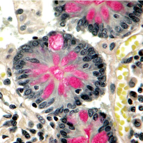 EZ Mucicarmine A stain to demonstrate acid mucopolysaccharides