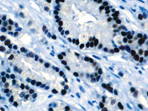 IHC of Androgen on a FFPE Prostate Tissue