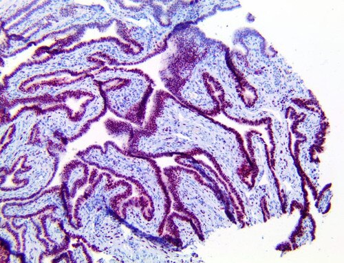 IHC of PolyDetector HRP Mulberry staining on a FFPE Fallopian Tube Tissue