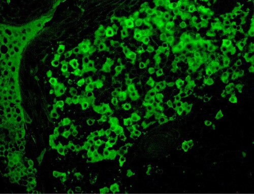 IHC of Lambda\FITC on a FFPE Tonsil Tissue