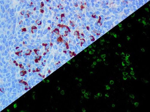 IHC of Lambda on a FFPE Tonsil Tissue, IF on a Frozen Tonsil Tissue