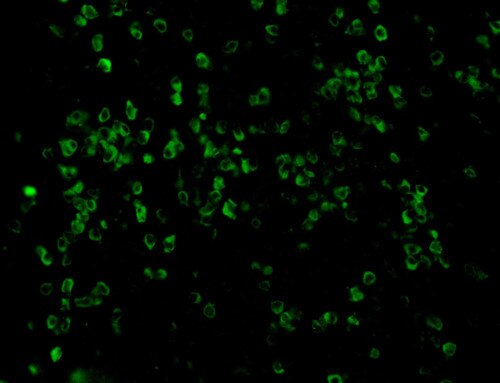 Lambda Antibody Immunofluorescence on a Frozen Tonsil Tissue