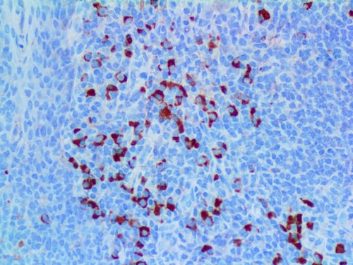Lambda Antibody Immunohistochemistry on a FFPE Tonsil Tissue