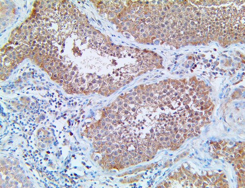 IHC of GAB1 on a FFPE Testis Tissue