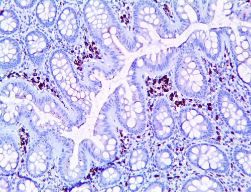 IHC of Cathepsin K on a FFPE normal Colon Tissue