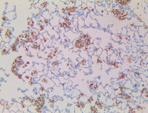 Candida Albicans Antibody Immunohistochemistry on an FFPE Artificially Infected Rat Lung Tissue