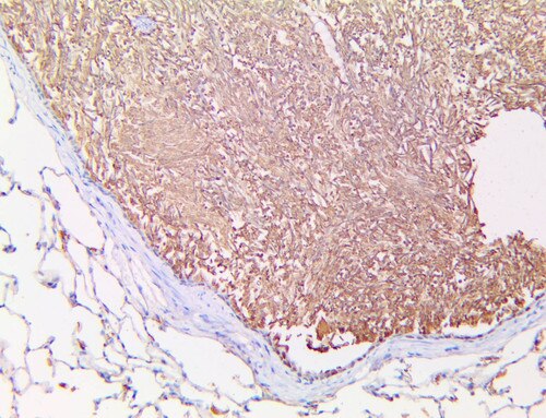 IHC of Aspergillus on a FFPE Aspergillus Infected Rat Lung tissue Tissue