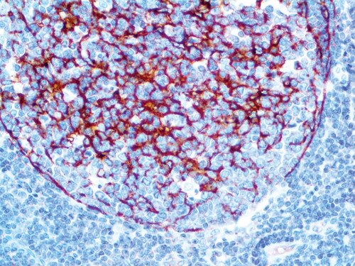 IHC of Clusterin / Apolipoprotein J Antibody on a FFPE Tonsil Tissue