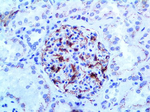 IHC of VEGFA Antibody on a FFPE Kidney Tissue