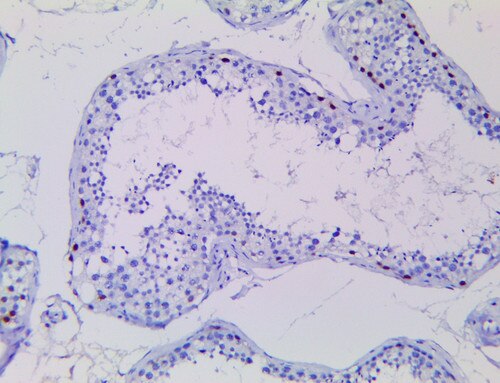 IHC of MDM2 on a FFPE Testis Tissue