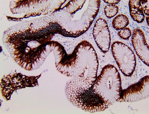 IHC of Claudin 18.2 on an FFPE Esophagogastric Junction tissue
