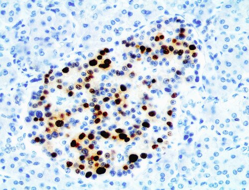 IHC of NKX6.1 on an FFPE Normal Pancreas tissue