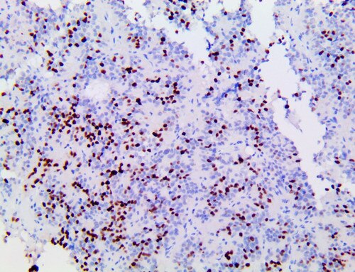 IHC of PiT-1 on an FFPE Normal Pituitary Gland tissue