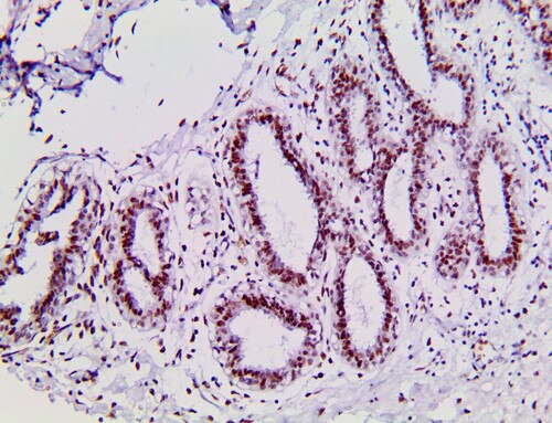 IHC of BAP1 on an FFPE Normal Breast tissue