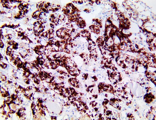 IHC of Prolactin on an FFPE Normal Pituitary Gland tissue