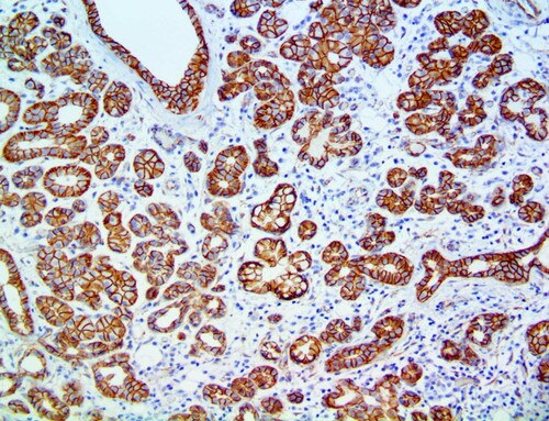 IHC of Beta-Catenin on Salivary Gland Tissue