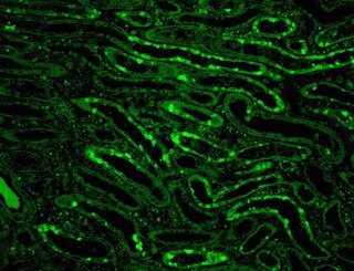 IF of C4c\FITC on a FFPE Lupus Positive Tissue