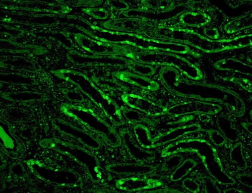 IF of C4c\FITC on a FFPE Lupus Positive Tissue