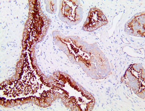 IHC of CD10 on a FFPE Prostate Tissue