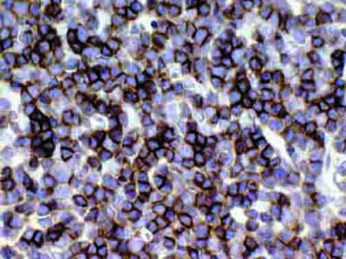 IHC of CD1a on an FFPE Thymus Tissue