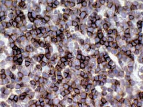 IHC of CD1a on an FFPE Thymus Tissue