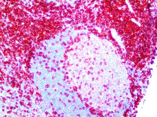 IHC of CD4 on an FFPE Tonsil Tissue