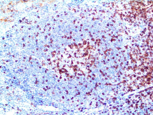 IHC of CD5 on a FFPE Tonsil Tissue